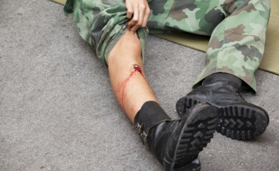 אושר בקריאה ראשונה: חייל שנפצע במהלך חופשה ממושכת יוכר כנכה צה"ל