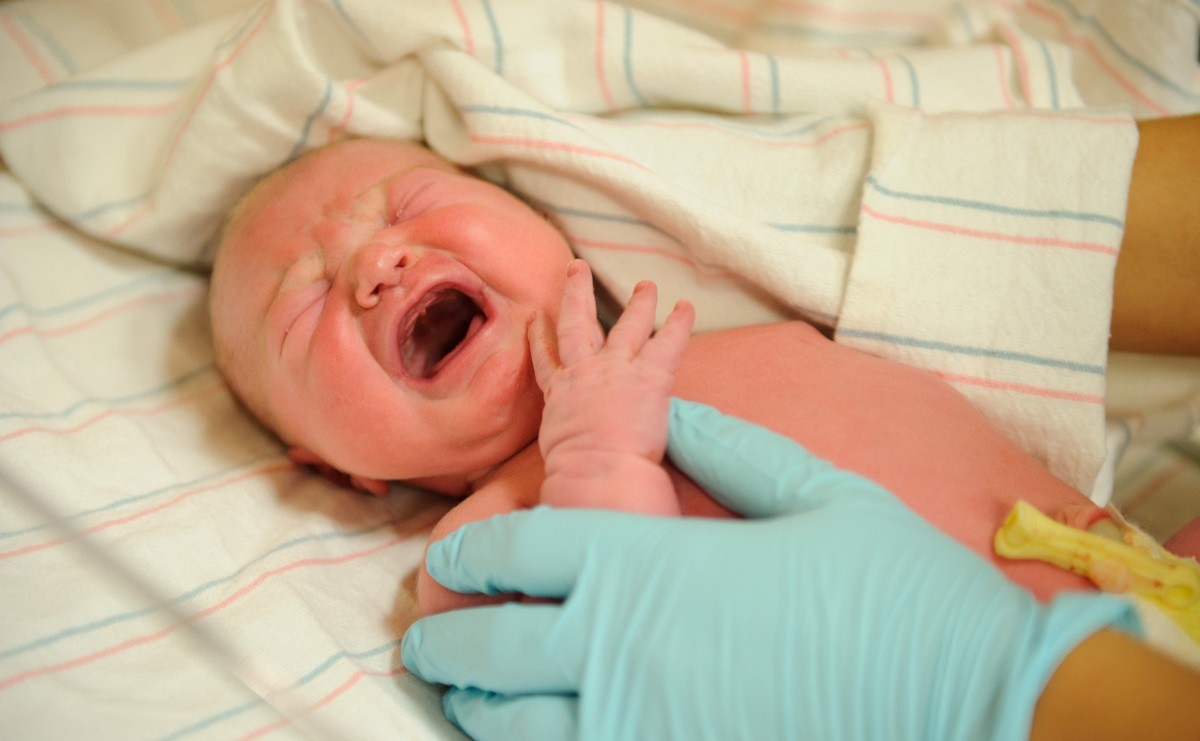 רשלנות רפואית? 3 תינוקות מתוך כל 1,000 לידות יוולדו עם שיתוק מוחין
