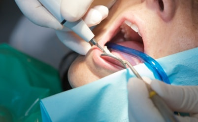 רופא השיניים לא מסר את המידע הדרוש? ישלם למטופלת פיצויים