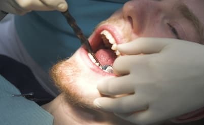 קופ"ח בטבריה תפצה על טיפול שיניים רשלני