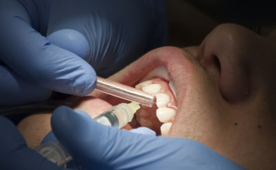 רופא שיניים ומבטחת יפצו מטופל בשל פגיעה באוטונומיה